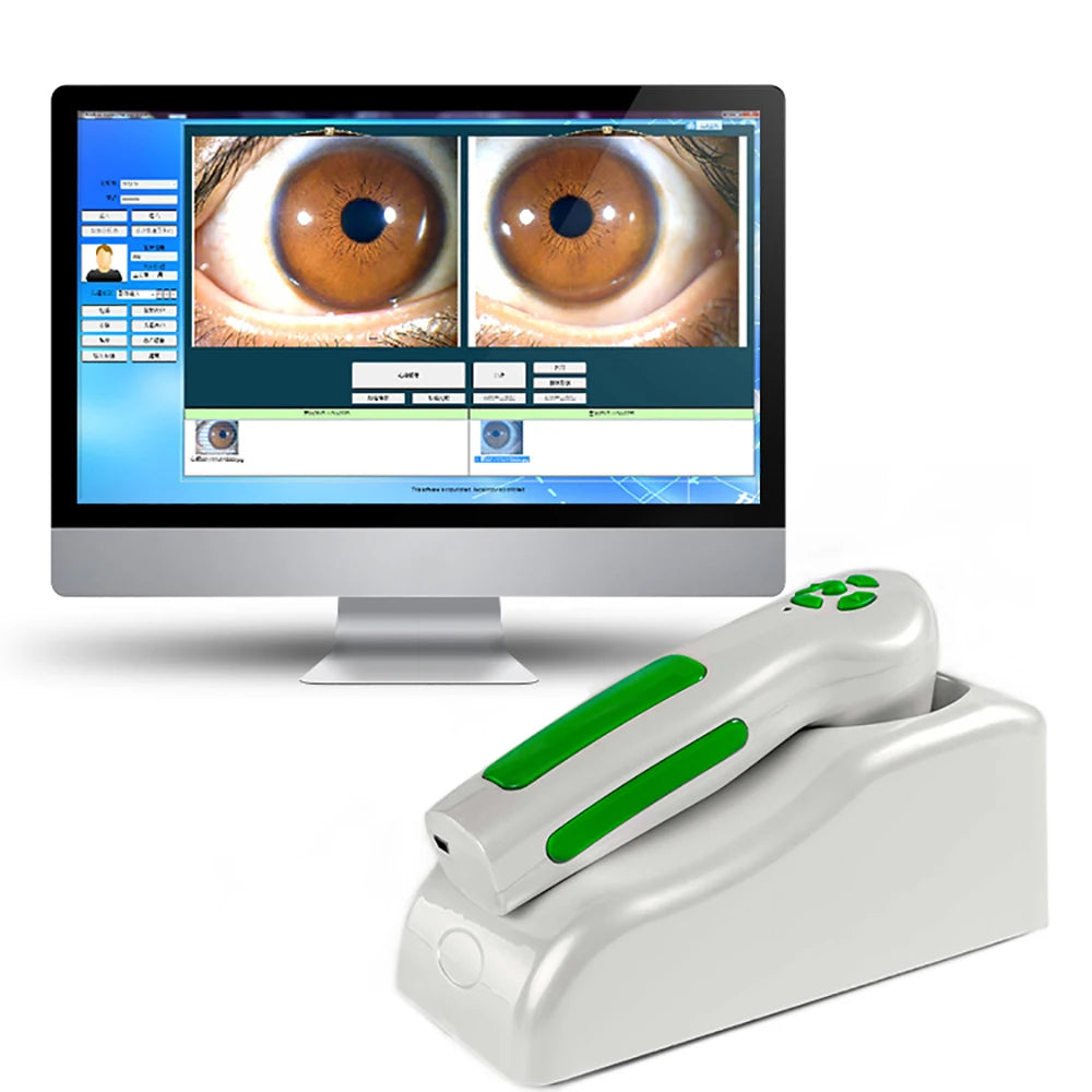 Digital Iris Analysis System Eye Iriscope Iridology Iris/hair/skin Analyzer Iriscope Iridology Camera Iris Analyzer 2026