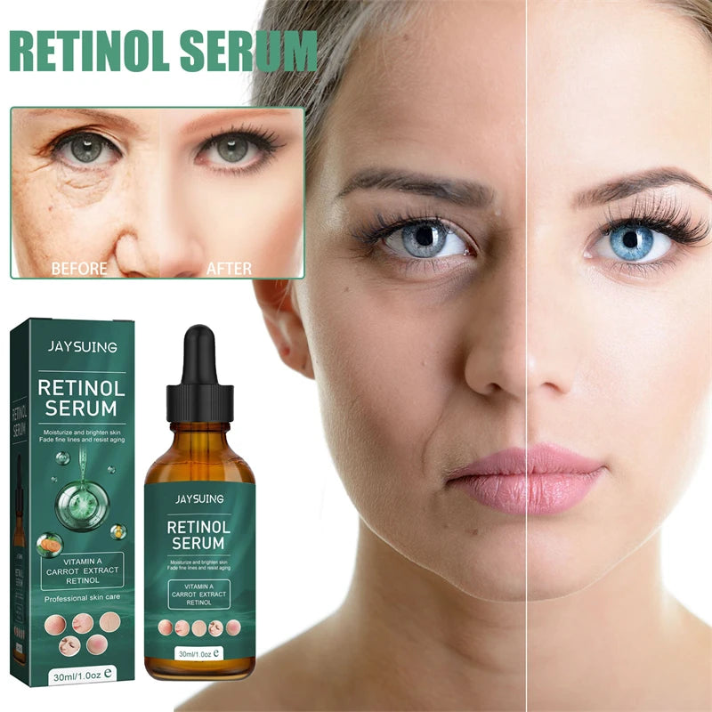 Jaysuing Anti Aging Retinol Serum Wrinkle Acne Marks Blackhead Reducing Skin Brightening Tightening Face Serum Hydrating