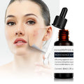 OEM/ODM Private Label Customized 30ml Bottle Dropper Repair Fade Acne Skin Care Liquids  Oligopeptides Facial Skin Care Serum