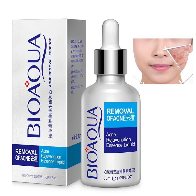 BIOAQUA Skincare Anti-acne Moisturizing Face Serum