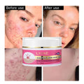 50ml Vegan Skin Care Niacinamide Collagen Moisturizing Skin Oil Control Acne Pimple Mark Removal Lightening Acne Face Cream