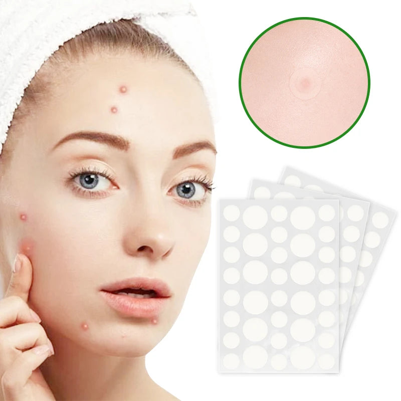 Hydrocolloid Acne Patch Pimple Spot Custom Anti-Patch Treatment Sample Size Private Label Tea Tree Oil Face All Skin Types