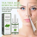 30 ml Herbal Plant Pimple Facial Serum Anti Wrinkle Aging Moisturizing Whitening Acne Remover Skin Repairing Serum