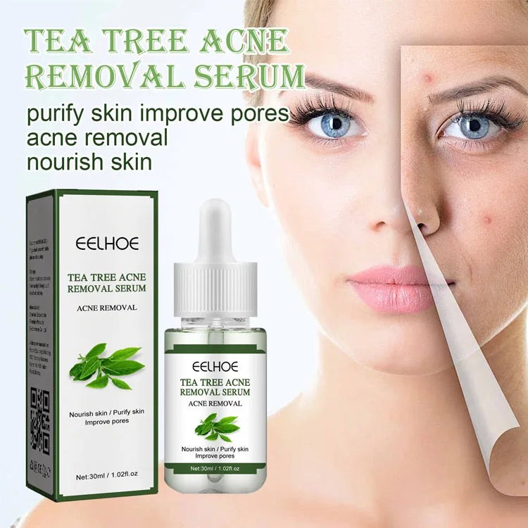 30 ml Herbal Plant Pimple Facial Serum Anti Wrinkle Aging Moisturizing Whitening Acne Remover Skin Repairing Serum