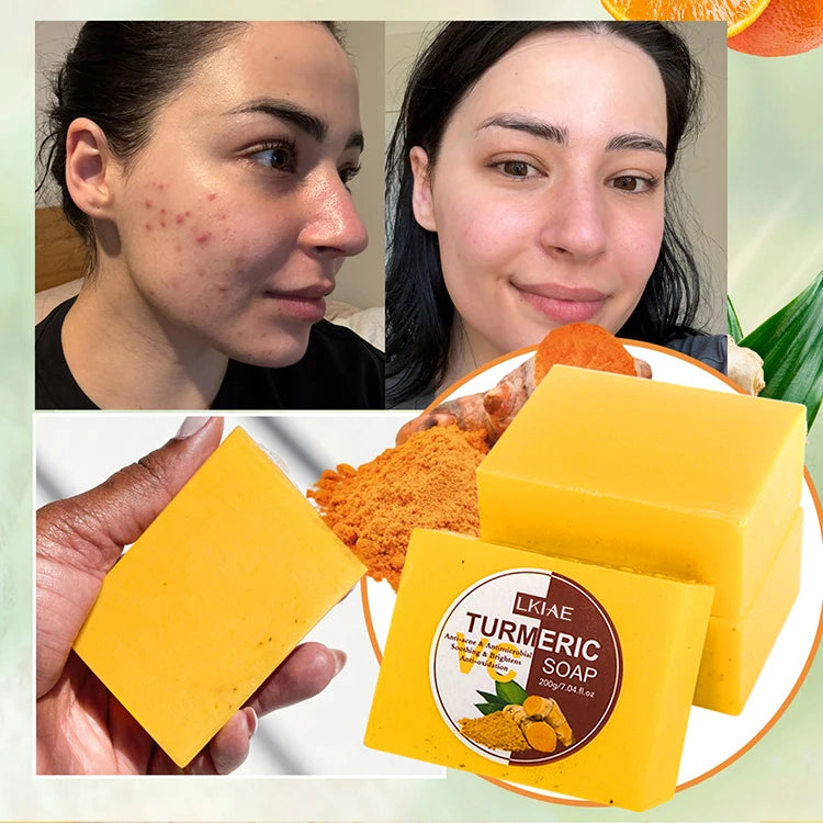 Wholesale Vegan Turmeric Extract Beauty Remove Dark Spots Anti Acne Whitening Organic Handmade Bathing Soap