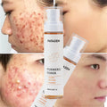 Private Label Skin Care Moisturizing Turmeric Facial Mist Repair Toner Spray Natural Organic Deep Hydrating Turmeric Face Toner