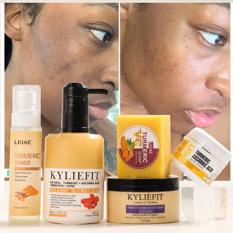 OEM Beauty Turmeric Vitamin C Witch Hazel Whitening Anti-Acne Body Cream Set