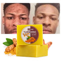 Private Label Face&Body Lightening Oil Control Cleansing Herbal Vitamin C Men Handmade Turmeric Acne Soap for Clarifying Skin