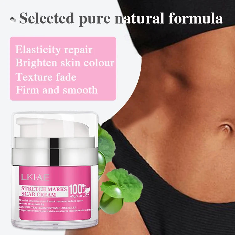 Wholesale Best Selling Camellia Japonica Oil Pregnancy Scar Removal Stretch Mark Removal Cream for Female