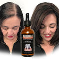 Private Label Hair Growth Serum Oil Biotin Regrowth Treatment for Scalp Hair Loss Thinning Hair Growth Serum for Men Women