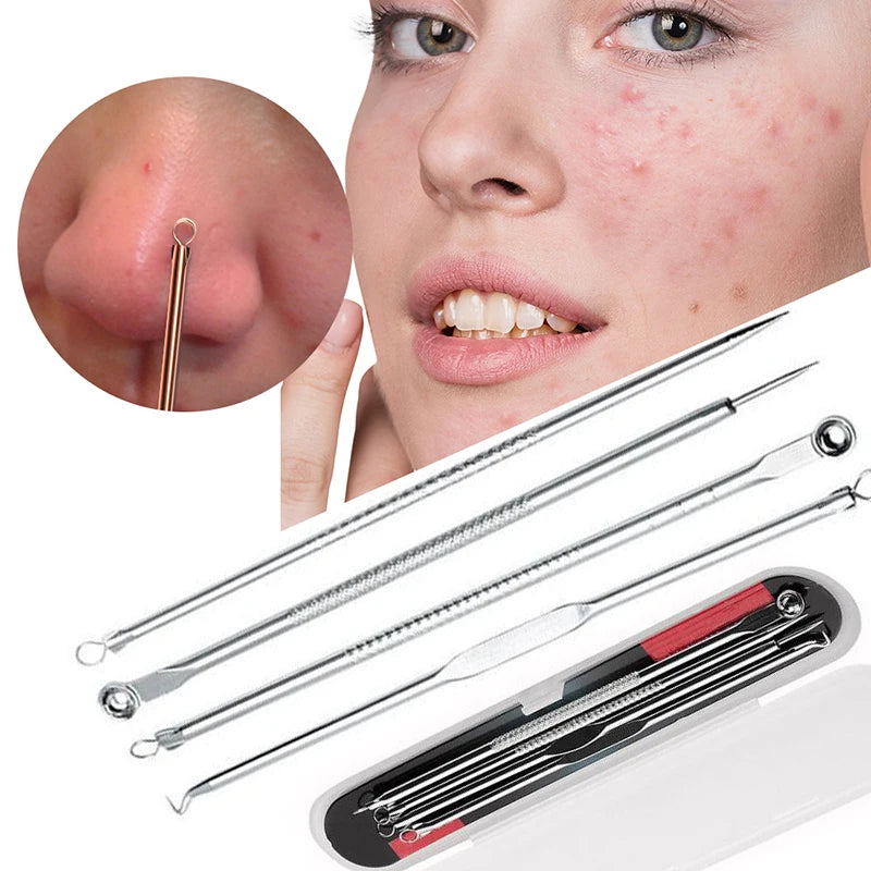 HelloWorld 4pcs Blackhead Extractor Rose Gold Black Dots Cleaner Acne Blemish Remover Needles Set Black Spots Pore Cleanser Tool