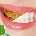 MABREM Dentist Tooth Whitening Professional Cleaning Teeth Whitening Pen