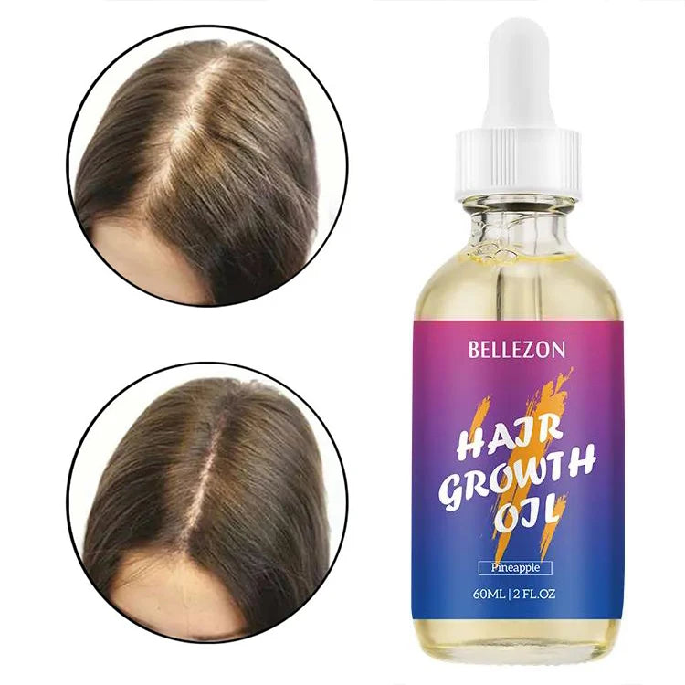 Private Label 60ml Best Selling Tea Tree Lightweight Fast Baby Scalp Hair Growth Oil Vendors