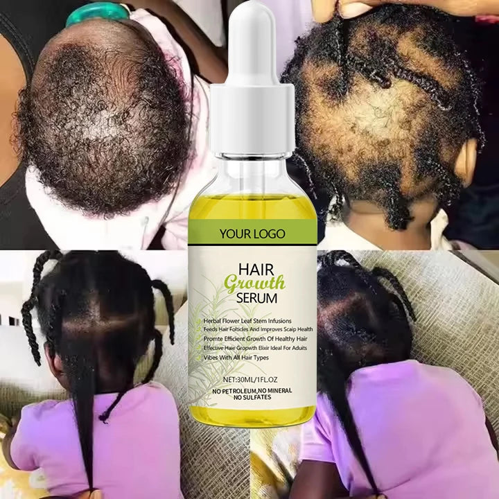 Private Label 100% Natural Hair Growth Oil Serum Rosemary Mint for Scalp Strengthening and Repair Promotes Hair Growth