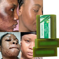 Natural 100g Aloe Vera Extract Moisture Aloe Vera Herbal Essential Oil Soap Facial Soap Private Label Custom Soap bar