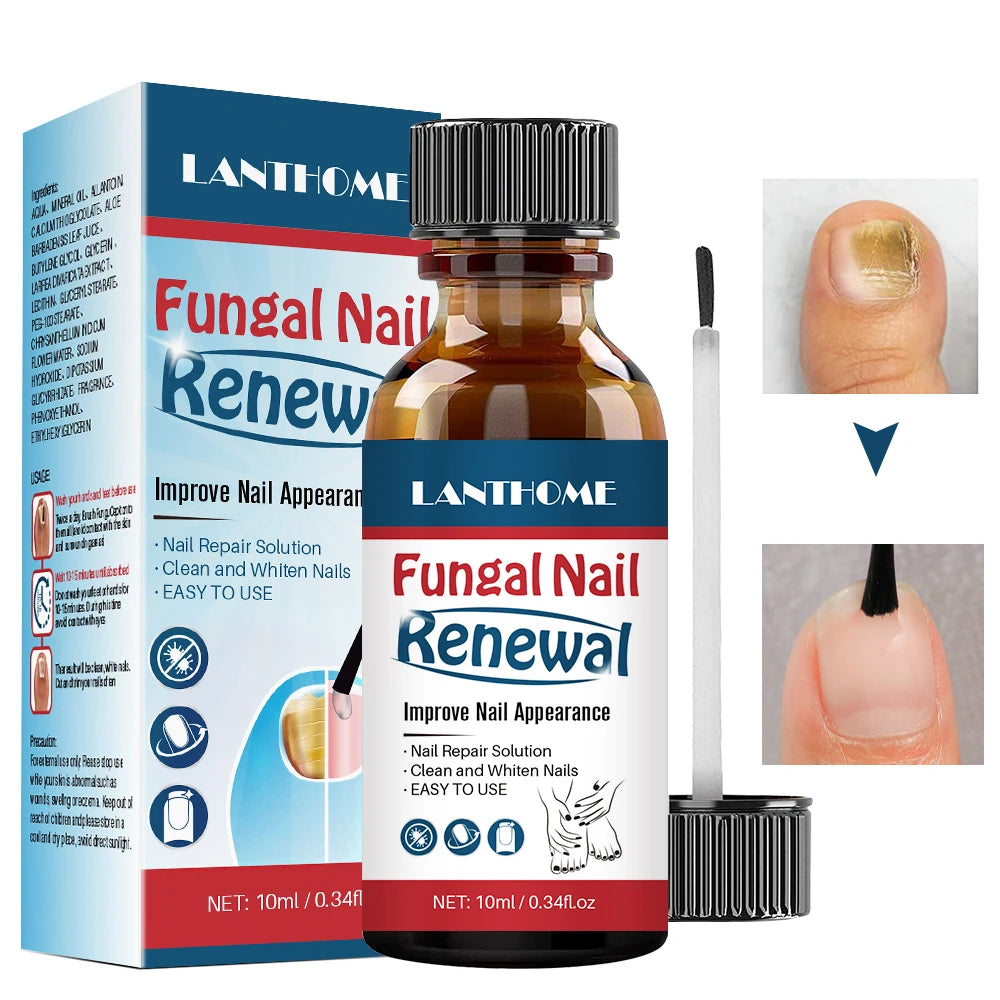 LANTHOME 10ml Nail Repair Solution Clean Whiten Nourish Nails Fungal Treatment Toe Nail Fungus Treatment