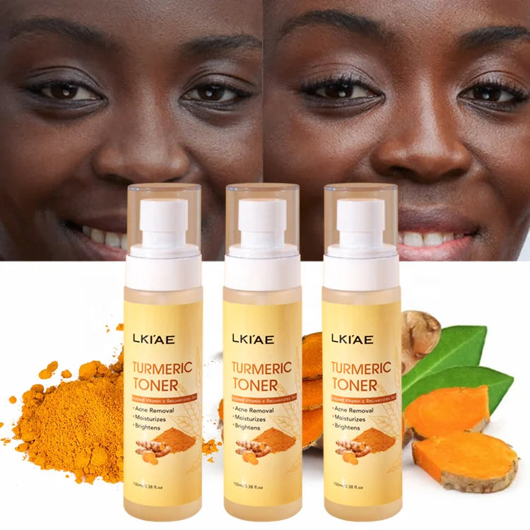 OEM ODM Brightening Moisturizing Organic (New) Bottle 100Ml Face Turmeric Face Toner Skin Care Products