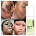 Skincare Fast Anti-Acne Clearing Hyaluronic Acid Organic Herbal Nourishing Moisturizer Purifying Face Serum