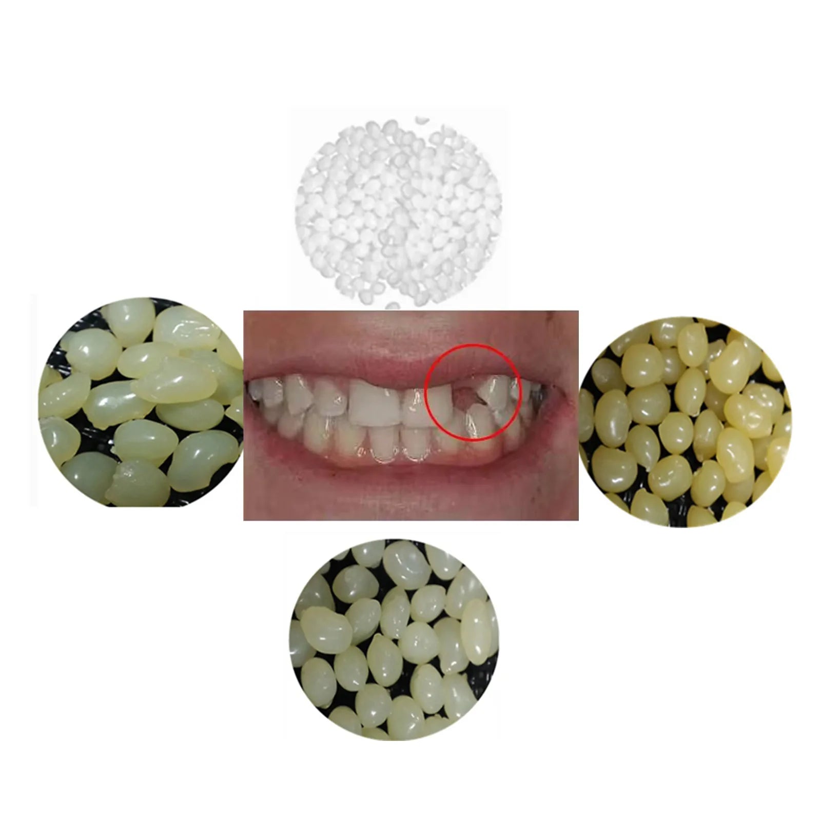 4 Colors New Dental Restoration False Teeth Tooth Repair Perfect Smile Veneers Comfort Fit Flex Dentures Braces Adhesives Glue