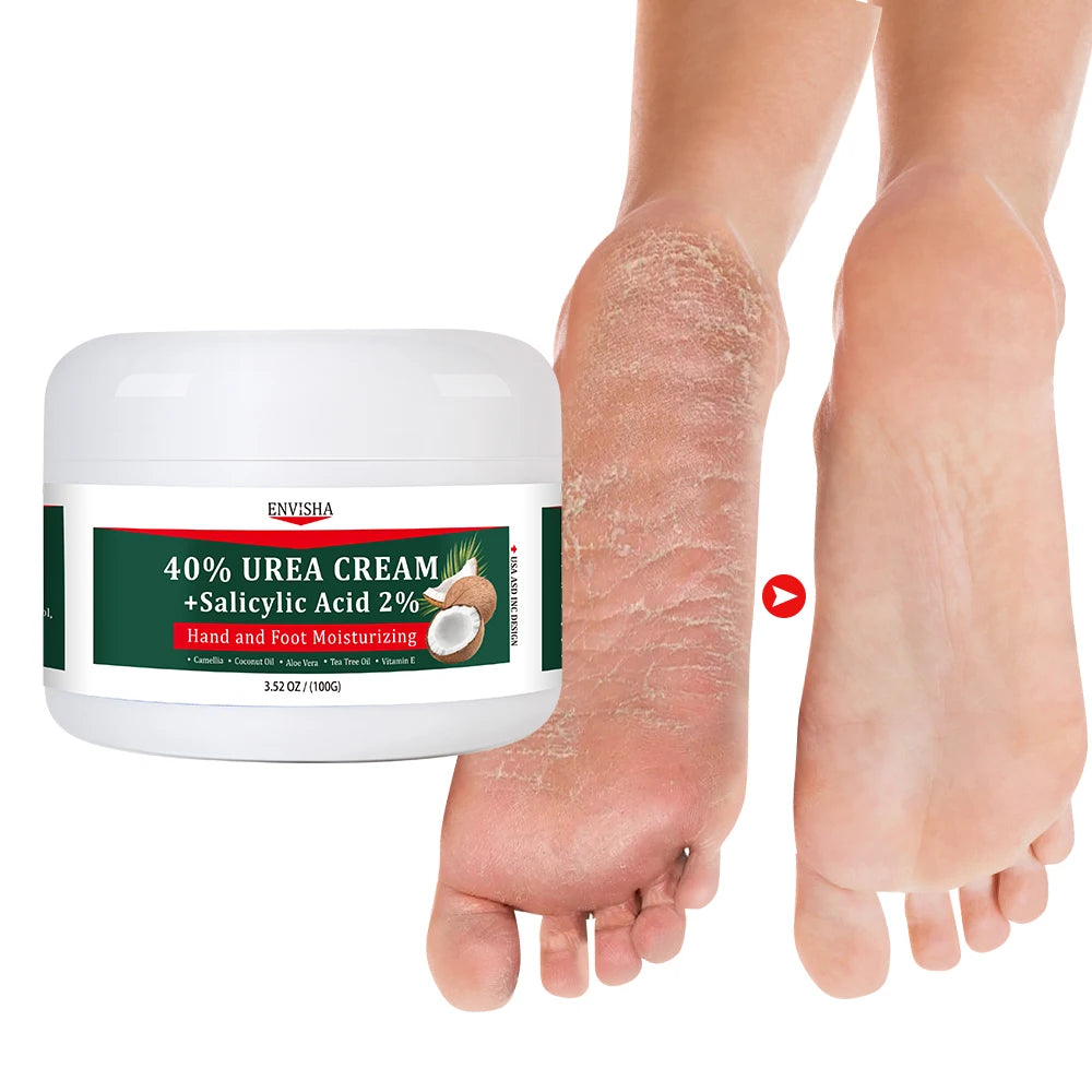 Private Label Body Hand Foot Care 40% Urea Cracked Heels Intensive Lightening Nourishing Hand and Foot Moisturizing Cream