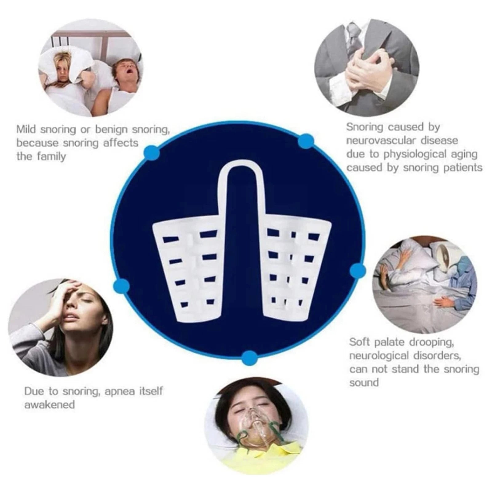 4Pcs Mini Anti Snore Nasal Dilator Nose Spreader Device Apnea Nose Clip for Sleeping Aid Equipment