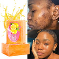 2024 Hot Selling Beauty Products Fruit Oily Face Body Brightening Glowing Skin Care Acne Whitening Soap for Women