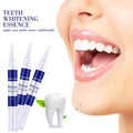 Safebond Beautiful Smile 16% Hydrogen Teeth Whitening Gel Pen Quick Effect No Harm Hot in Market with Private Label Logo Volume