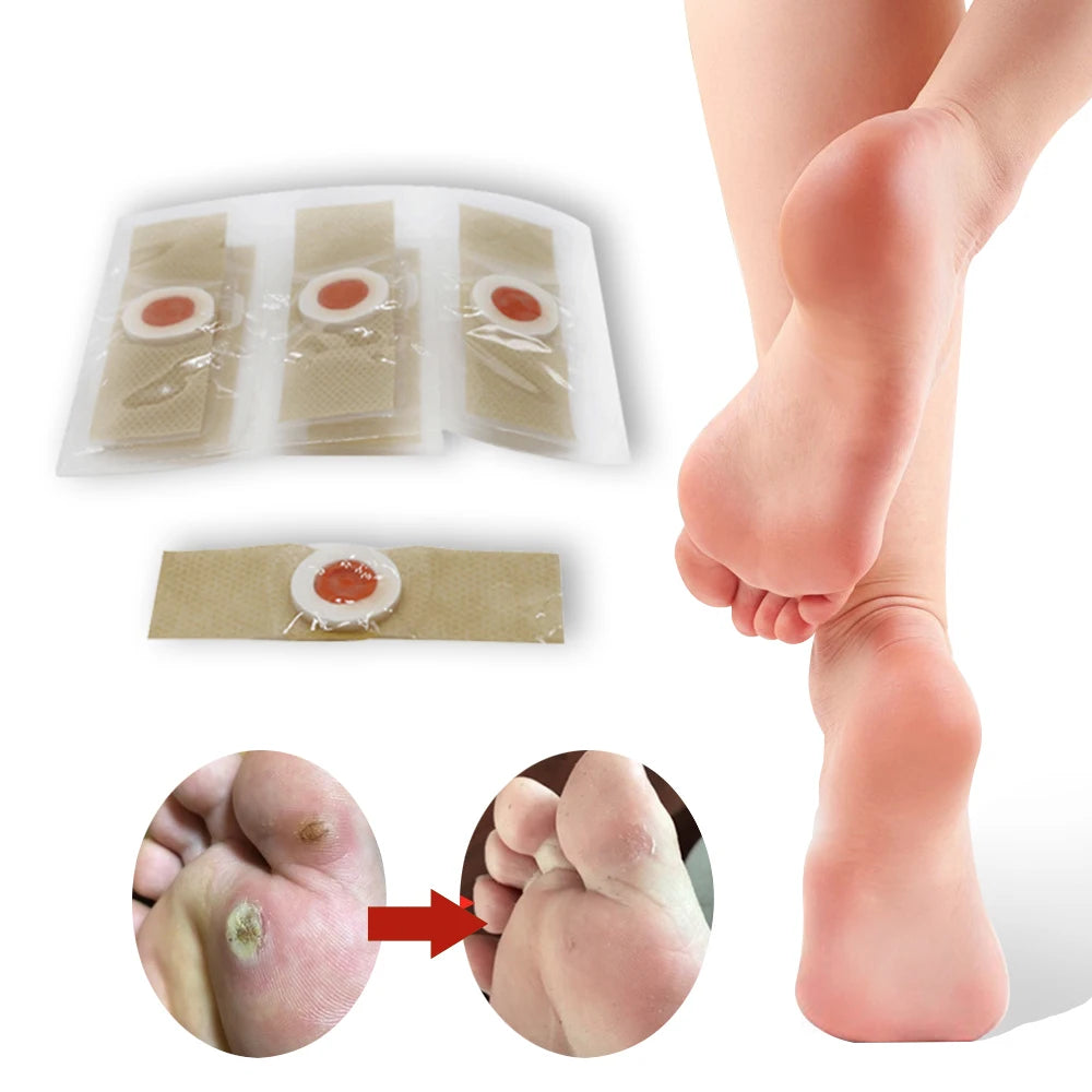 Popular Suppliers High Quality Plaster Corn Remover Patch for Foot