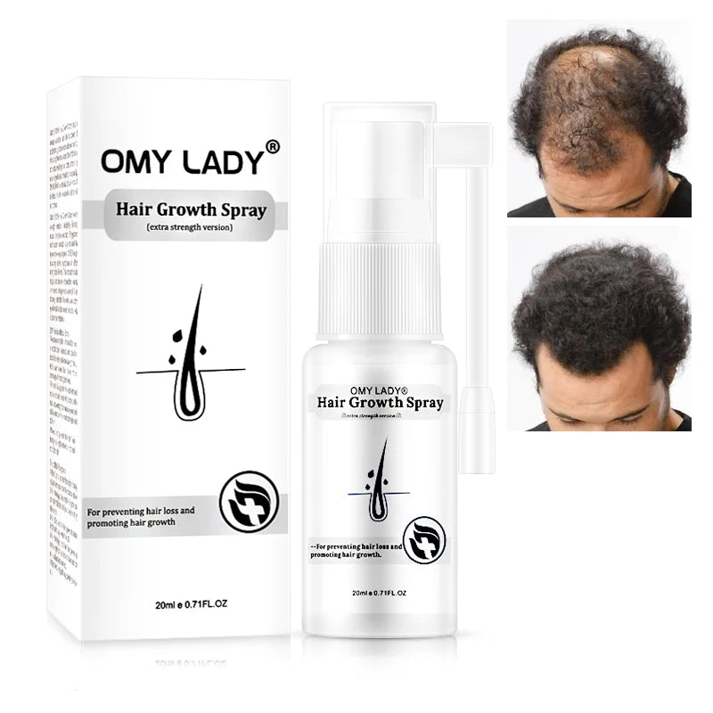 No Calvicie No Alopecia  Suero Reparador De Cabello Para Espana
