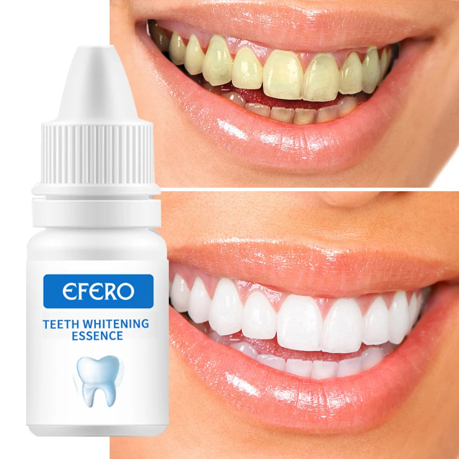 SHADOMAGIC Organic Multi-Purpose Teeth Whitening Gel 0.16 Fl.oz Lightweight Compact Removes Plaque 3 Year Shelf Life 1-2 Times
