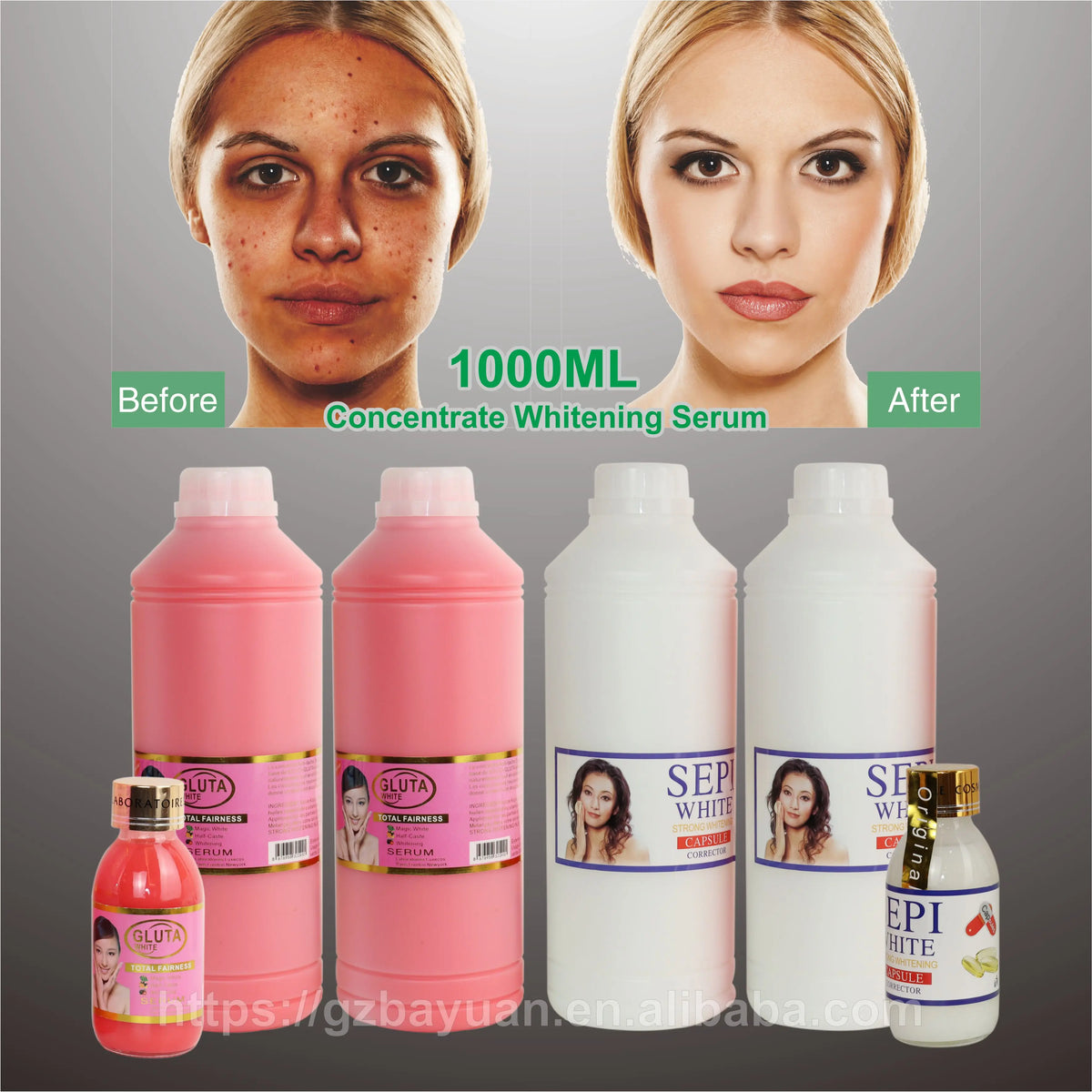 Sepi OEM 1L Concentration Serum Whitening Anti Wrinkle SkinCare Blemish Facial Kojic Acid Brighten Serums for Dark Spots Marks MegaBDM