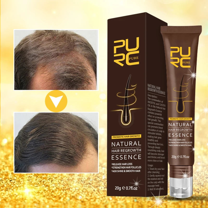 OEM Natural Hair Growth Serum Treatment Hair Loss Regrowth Oil