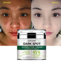 In Stock Body Bikini Face Acne Remove Anti Age Dark Spots Corrector Fade Whitening Cream