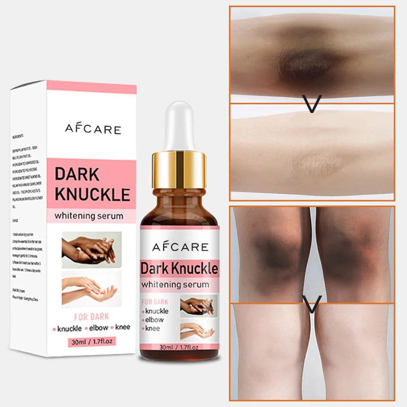 Sulfate-free Whitening Moisturizing Nourishing Aloe Vera Hyaluronic Acid Green Tea Dark Knuckles Removal Face Body Skin Care