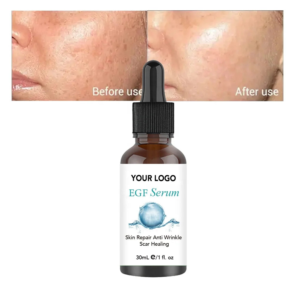 Organic Collagen Anti Aging Anti Wrinkle Skin Care Serum Moisturizing Private Label Egf Face Serum