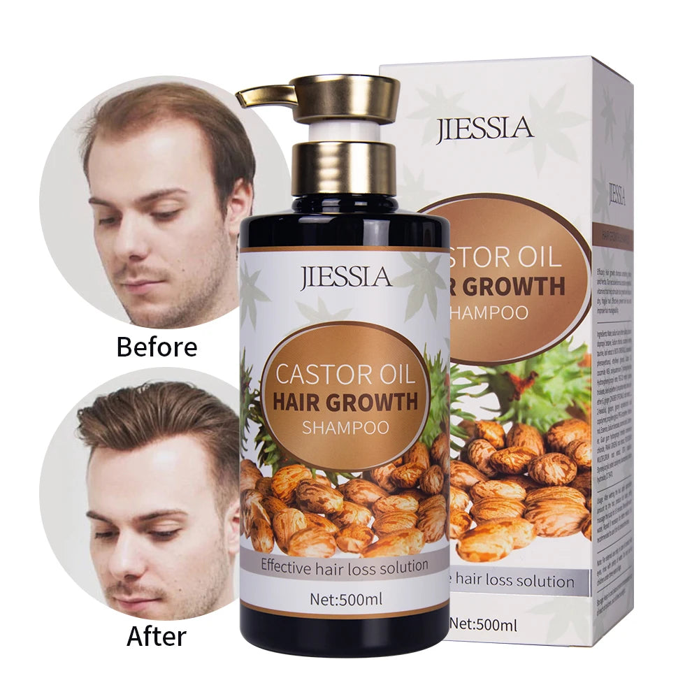 Hot Sale Wholesale Price Care 100% All Moisturizing Shampoo Hair Growth Castor Oil Hair Growth Shampoo