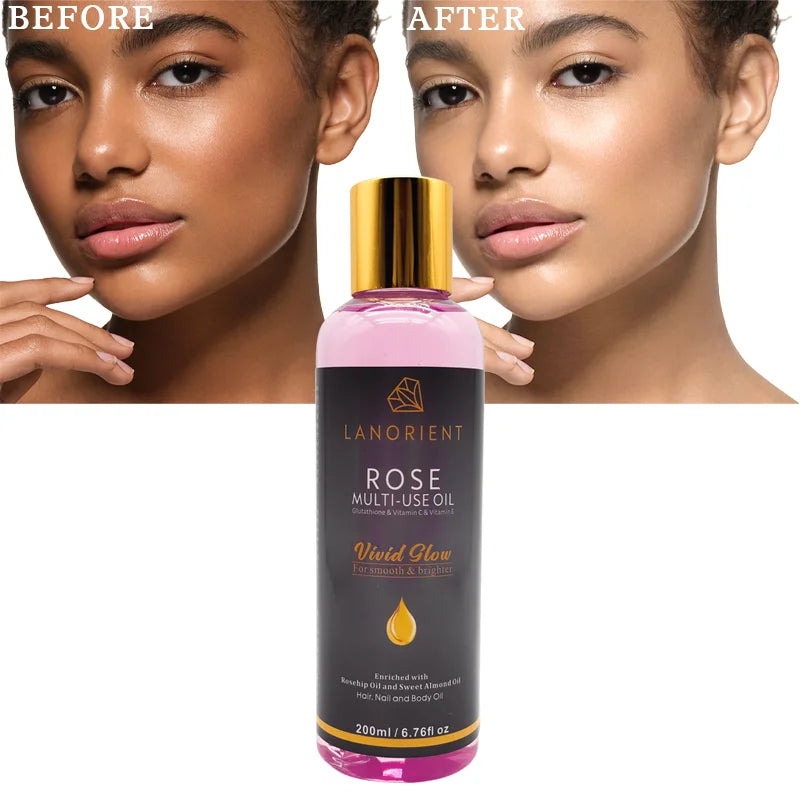 Private Label Natural Organic Skin Care Products Vitamin C Skin Whitening and Moisturizing Rosehip Oil for Face and Body