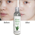 Skin Lightening Whitening Smoothing Soothing Aloe Vera Gel Face Neck Dry/Itchy Skin 100% Pure Natural Certified Organic