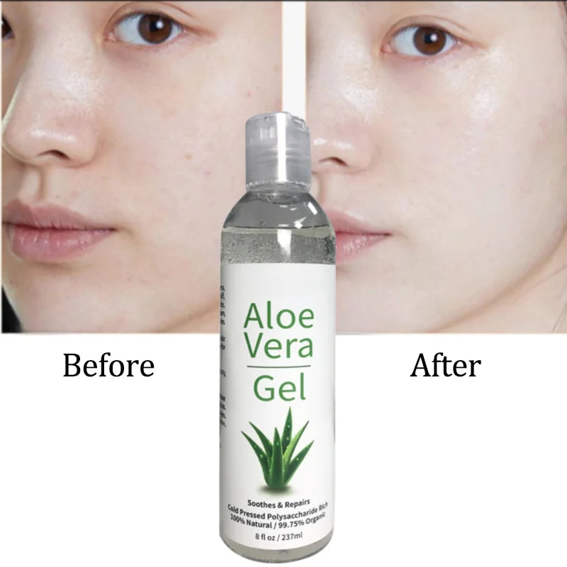 Skin Lightening Whitening Smoothing Soothing Aloe Vera Gel Face Neck Dry/Itchy Skin 100% Pure Natural Certified Organic