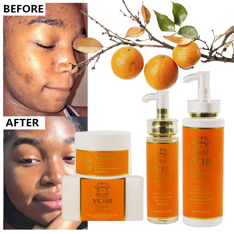 AILKE Organic Vitamin C Moisturizing Body Lotion Anti Aging Face Cream Firming Serum Brightening Soap Whitening Skin Care Set