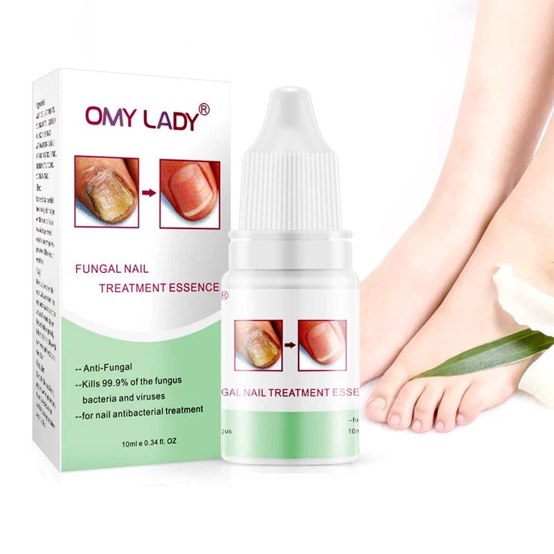 OMY LADY Kill Fungus Nails Treatment Best Nail Repair Set Stop Fungal Growth Effective Fingernail & Toenail Health Care MegaBDM