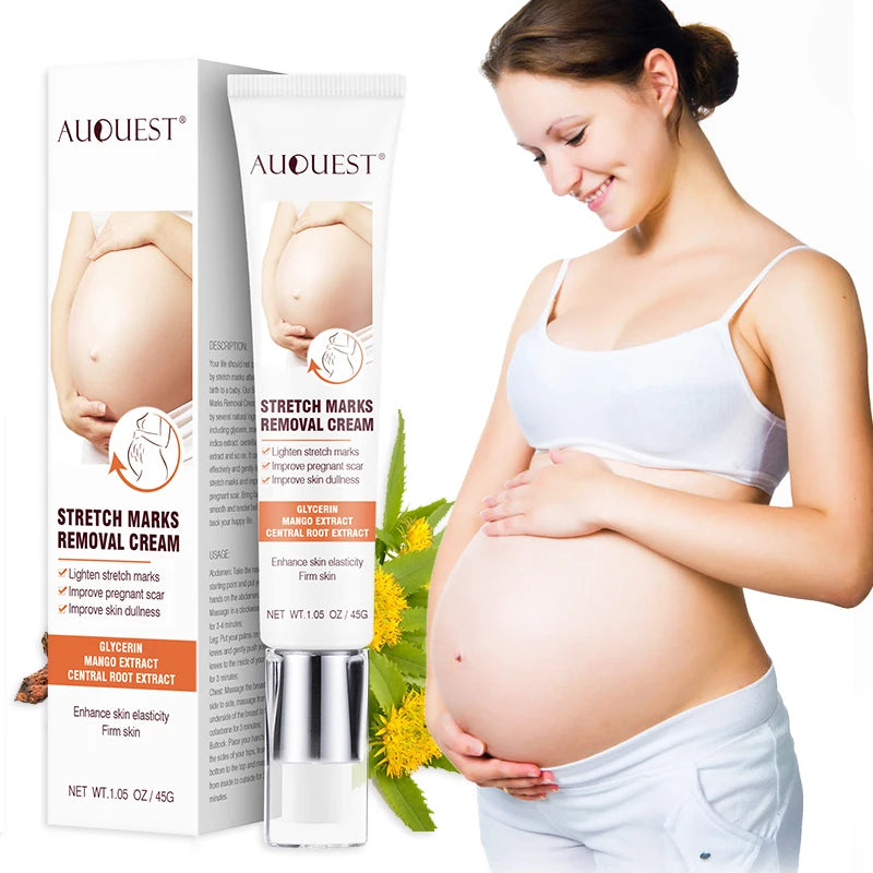 Wholesale 100% Natural Vegan Anti Postpartum Deep Acne Scar Removal Cream Best Stretch Marks Removal Cream