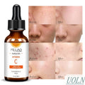 30ml Private Label Natural Beauty Facial Skin Care Whitening Moisturizing 20% Vitamin C Serum for Face