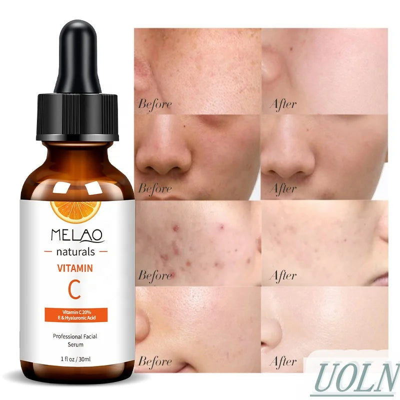30ml Private Label Natural Beauty Facial Skin Care Whitening Moisturizing 20% Vitamin C Serum for Face