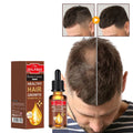 OEM Custom Private Label Anti Hair Loss  Zingiber Officinale Hair Oil Growth  for Men and Women