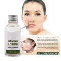 Manufacturer OEM ODM Green Tea Aloe Vera Anti-Acne Pimple Removing Serum Liquid 30ml Drying Lotion for Face Anti-Aging