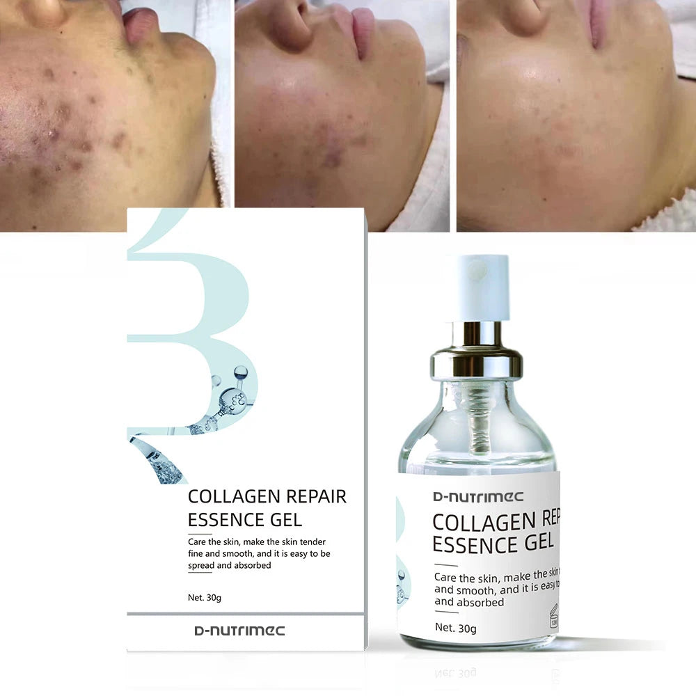 Custom Brand Recombinant Human Collagen Repair Serum Pigmentation Removal Collagen Dressing Face Skin Care Serum