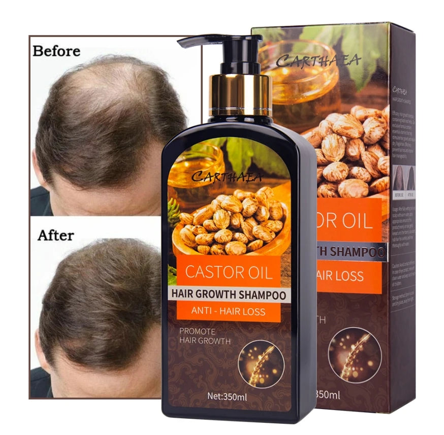 Ready to Ship Bald Hair Growth Shampoo