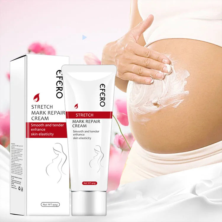 OEM/ODM Anti Stretch Marks Cream Repair Skin Nourishing Pregnancy Stretch Mark Removal Cream