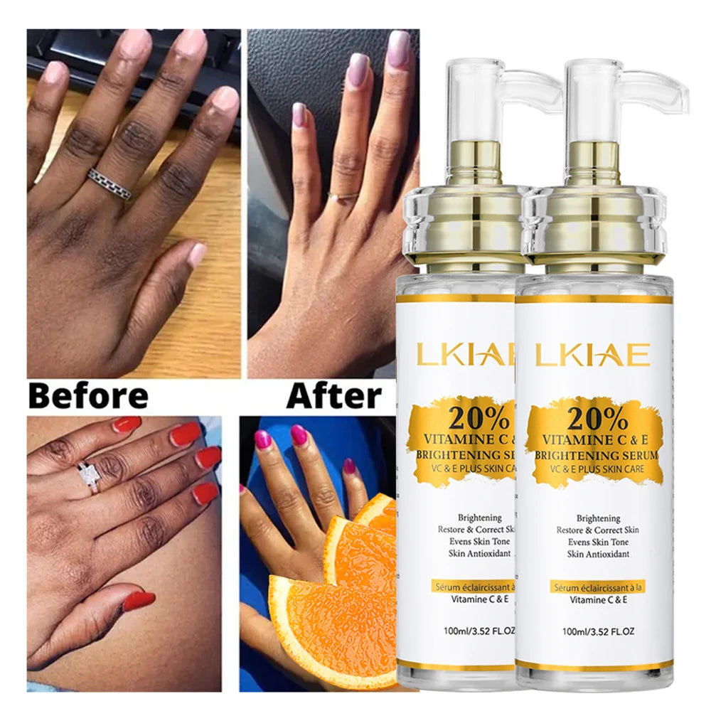 LKIAE Organic Vitamin C + E Brightening Dark Spot Remover Glowing Skin Bleaching Face Serum for Black Women